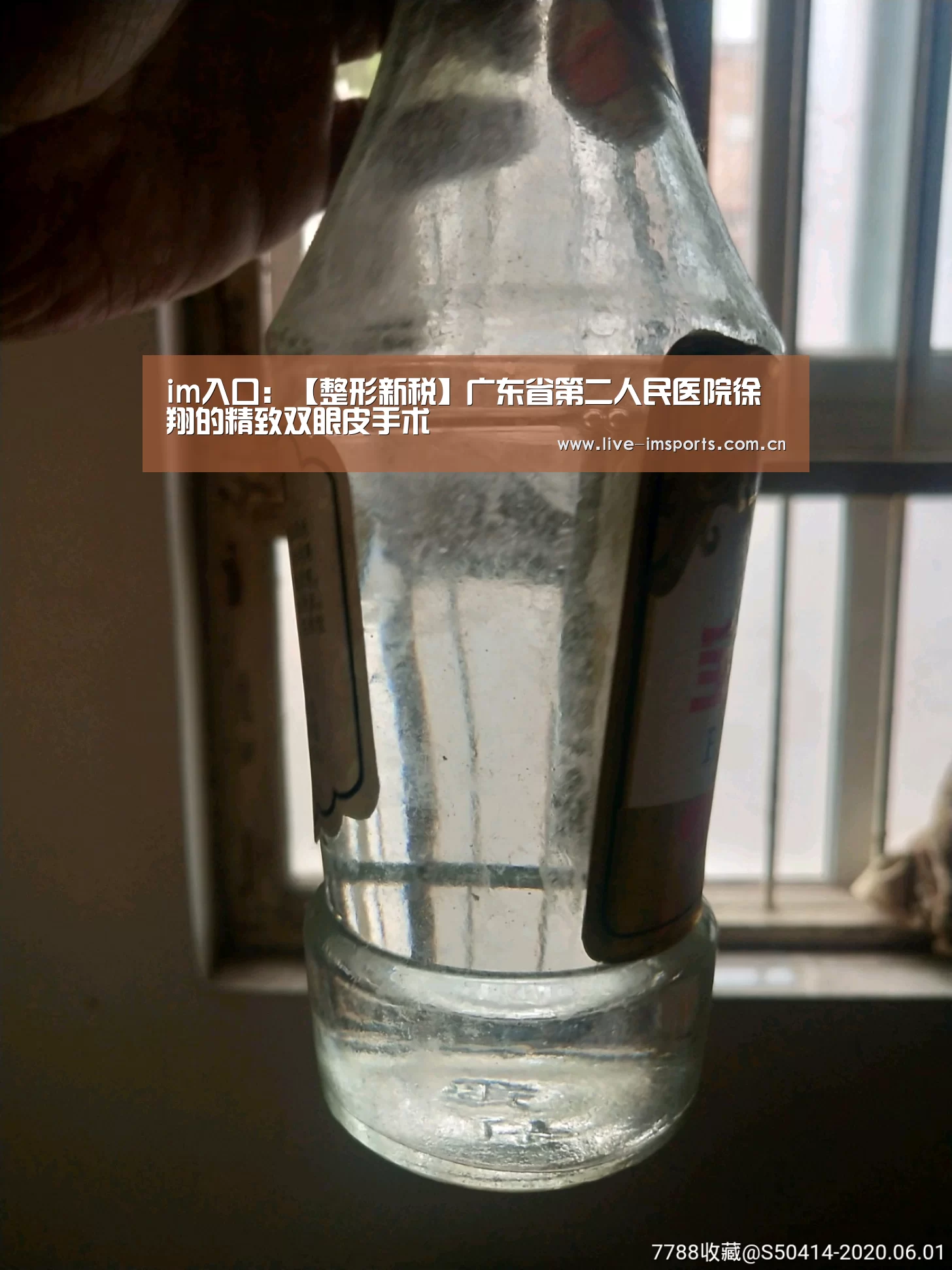 im入口:【整形新税】广东省第二人民医院徐翔的精致双眼皮手术(图1) im体育投注
